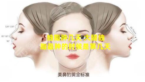 抽脂肿几天 大腿抽脂最肿的时候是第几天